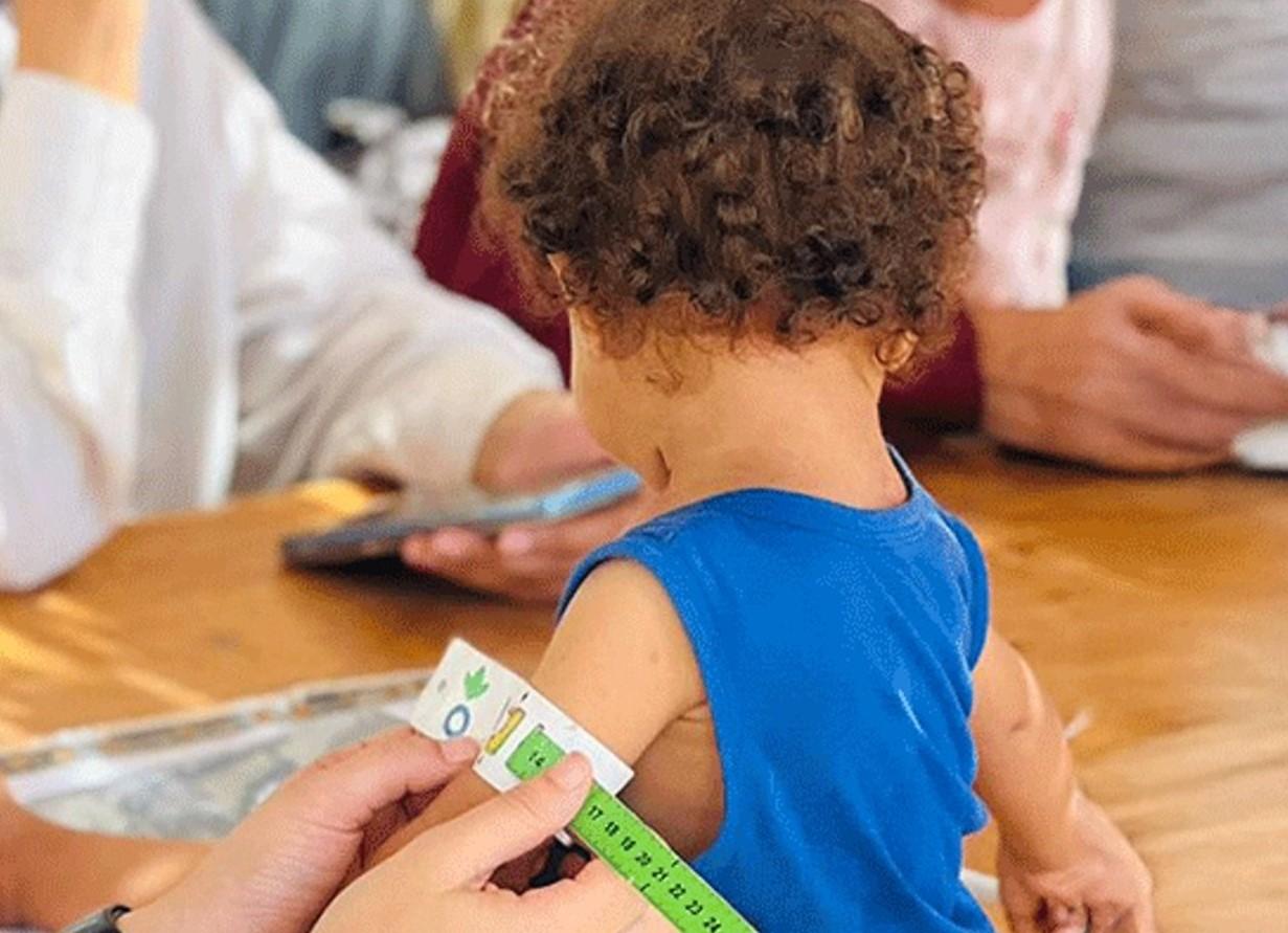 desnutricion infantil gaza
