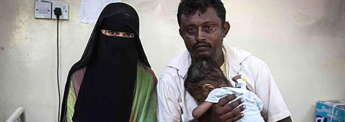 Yemen: 5 millones de personas al borde de la hambruna
