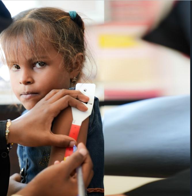 Yemen desnutrición