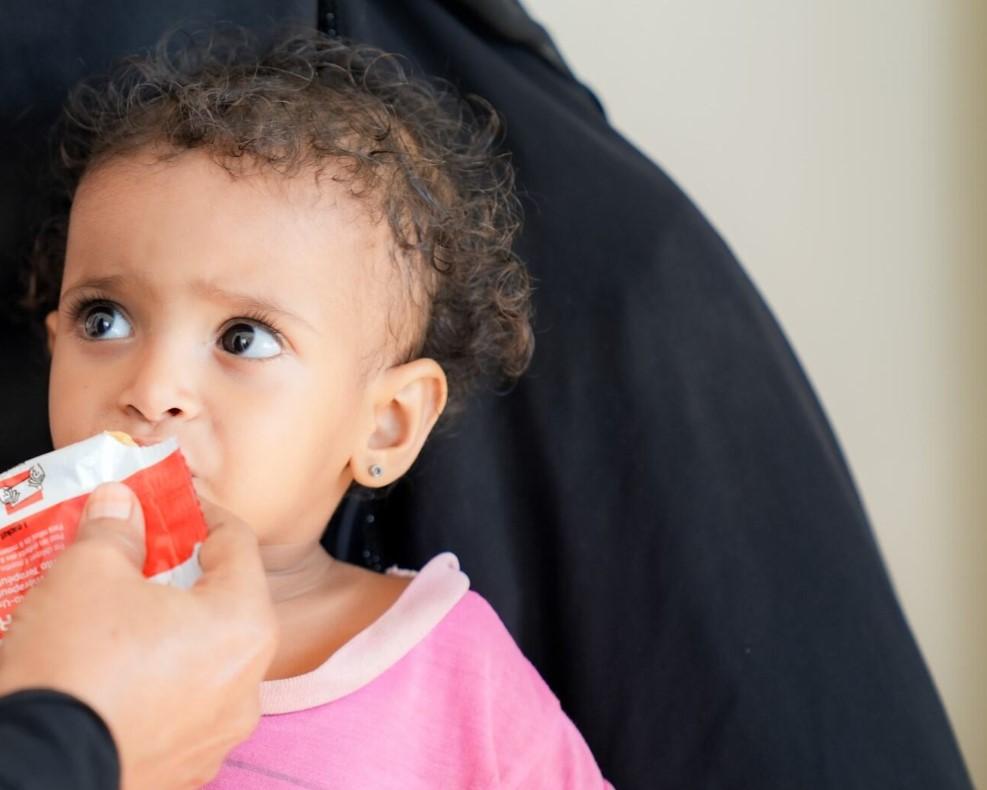 Yemen desnutrición