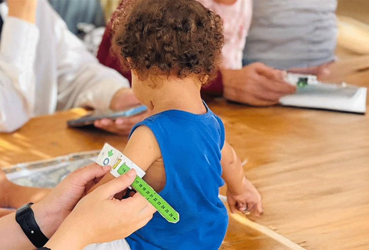 niño desnutricion infantil gaza